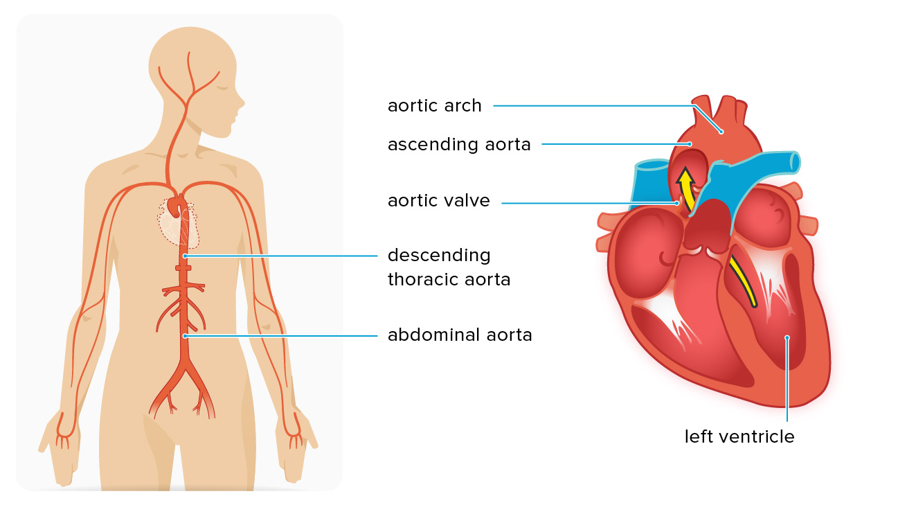 what happens after ascending aortic aneurysm surgery