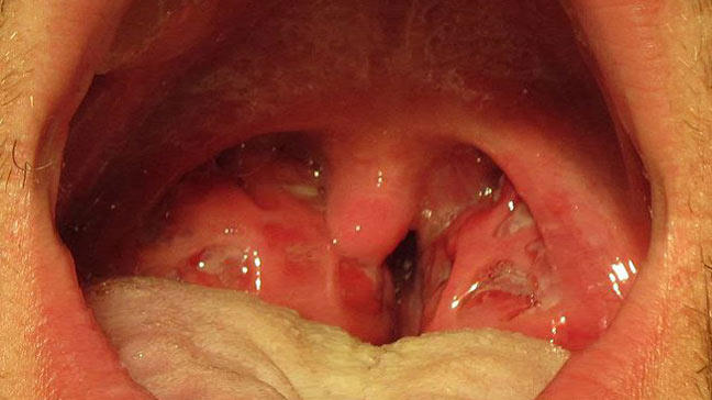 Pictures Of Step Throat 10