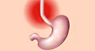 Acid reflux symptoms are caused when stomach contents flow up from the 