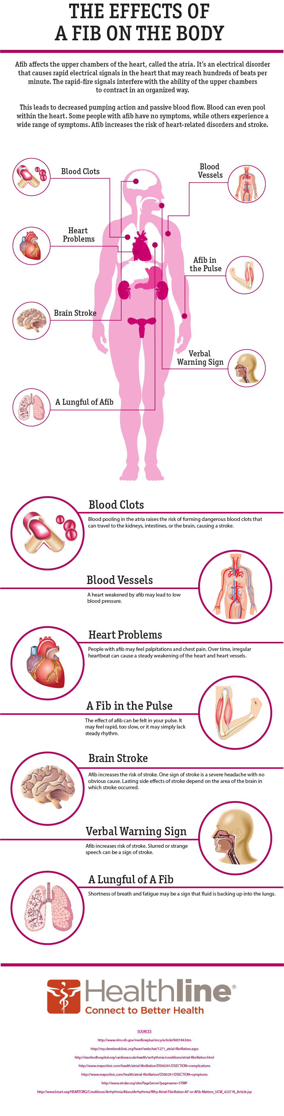 The Effects of Afib on the Body