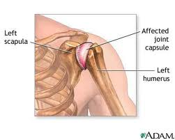What does pain in the left arm and shoulder indicate?