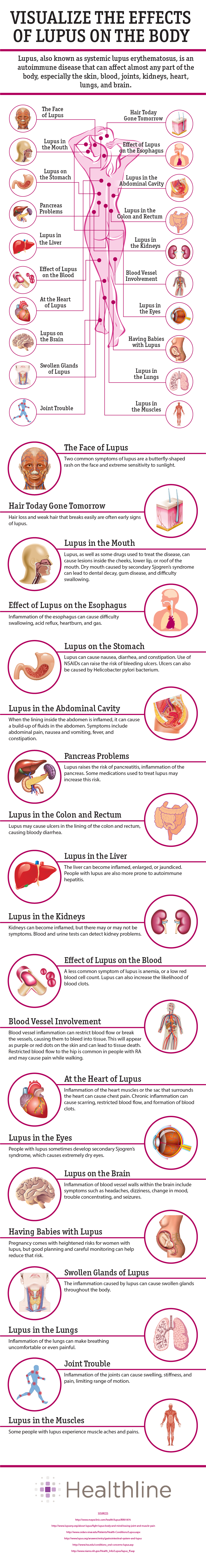 Effects of Lupus