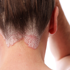 Itchy Bumps On Back Of Neck Near Hairline - HealthTap