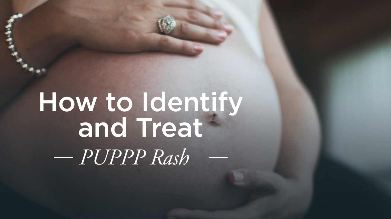Skin Rash (PUPP) During Pregnancy | What to Expect
