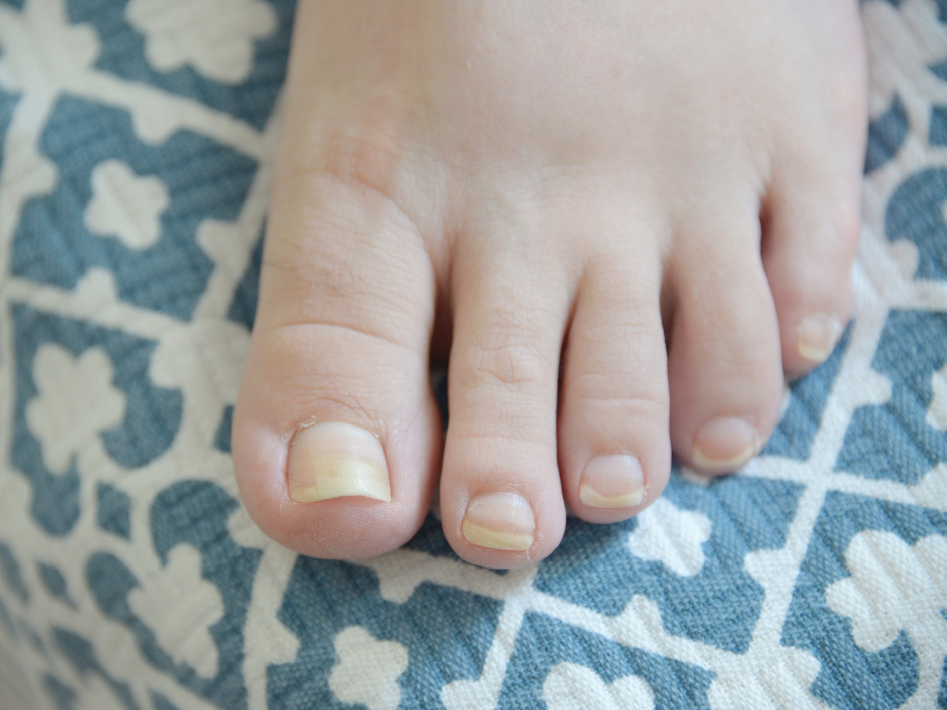 3. White Toenails With Abstract Design - wide 3