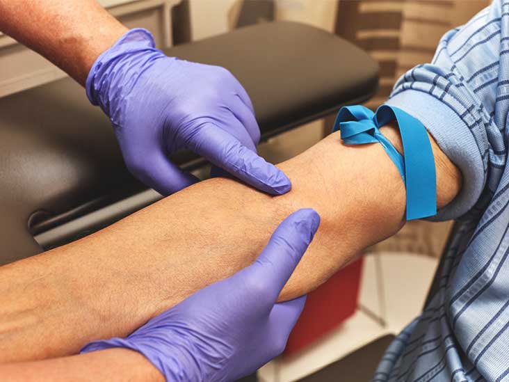 Do you have to fast before taking a PSA blood test?