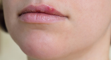 itchy lips causes - MedHelp