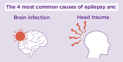 What are some medical causes of seizures?