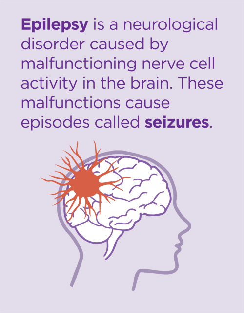 Can Fever Cause Seizures In Adults