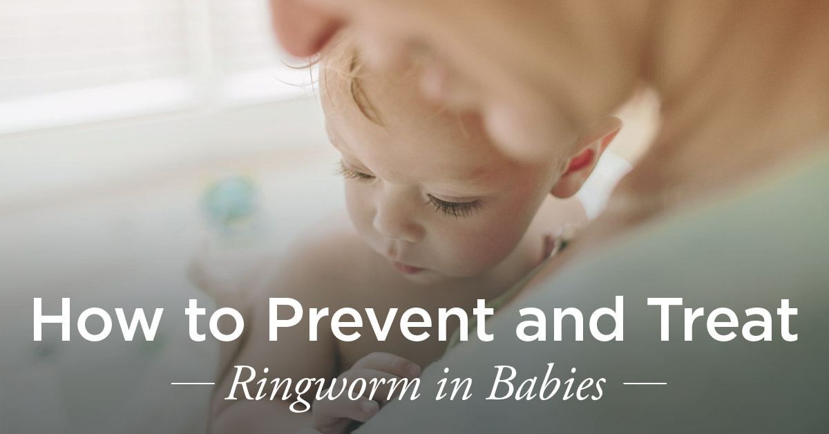 Ringworm in Babies: Treatment and Prevention