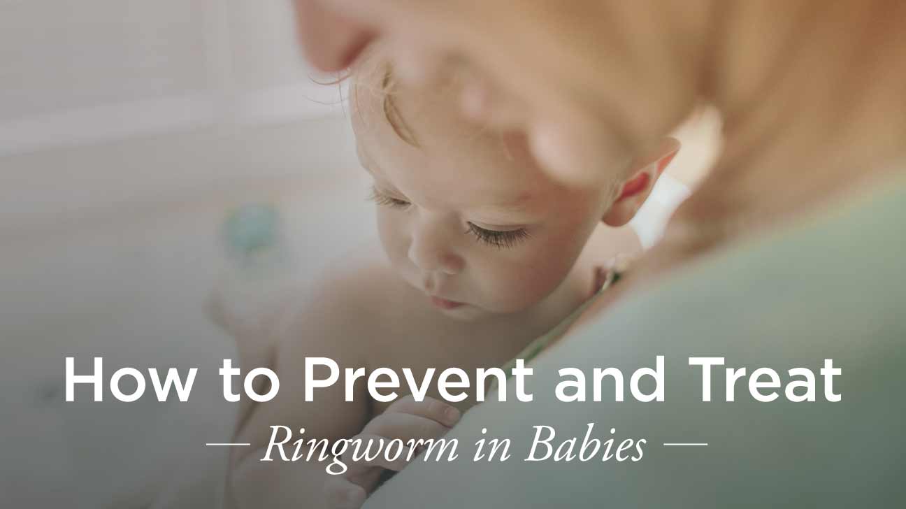 3 Ways to Treat Ringworm in Babies - wikiHow