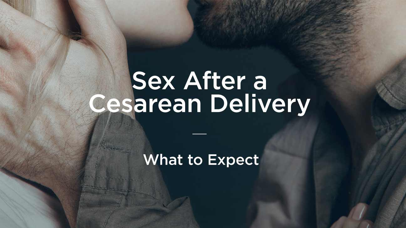 How Soon Can You Have Sex After A C Section 21