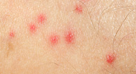 reddish spots on chest #10