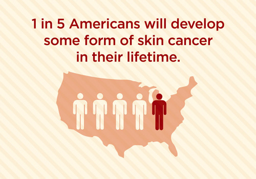 How can you reduce your chances of getting skin cancer?