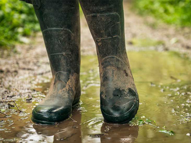 Trench Foot: Symptoms, Causes, Pictures, and Treatment