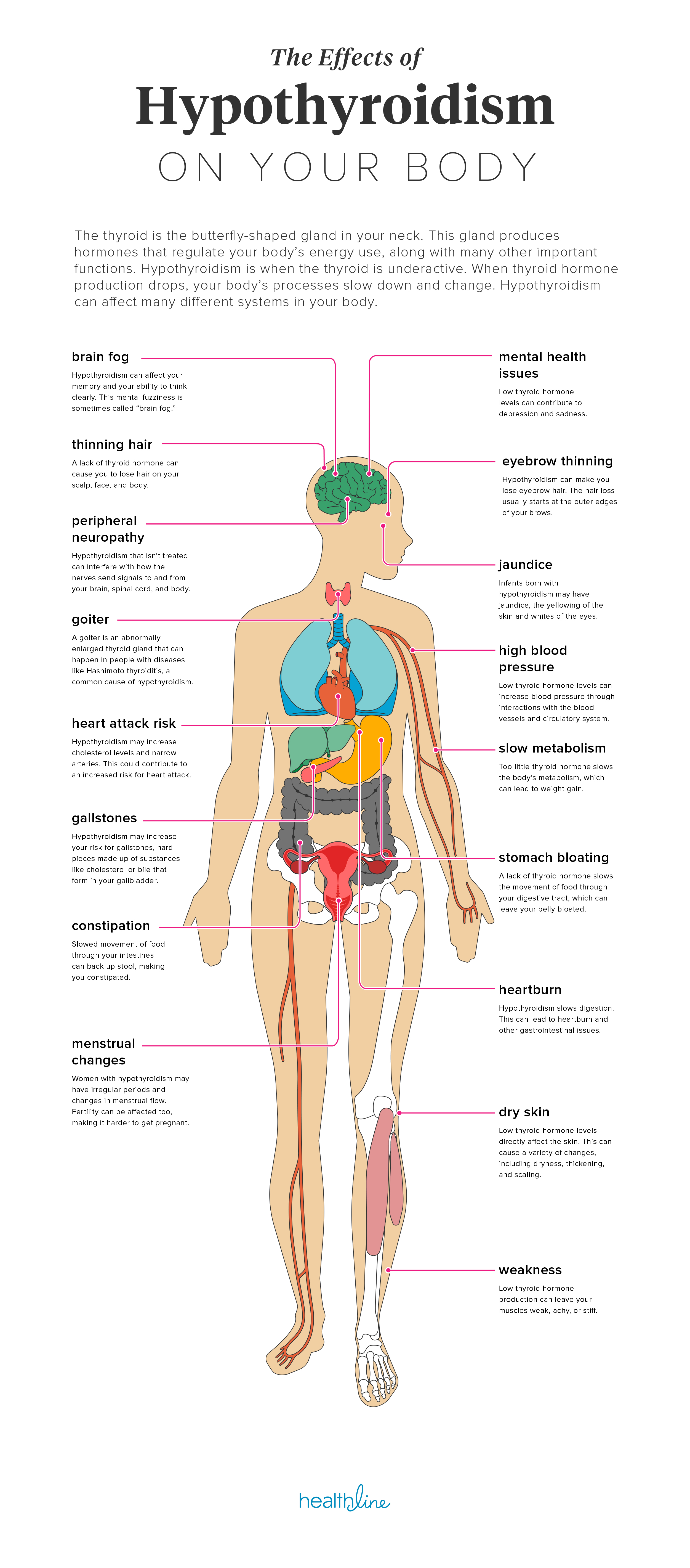 The Effects of Hypothyroidism on the Body