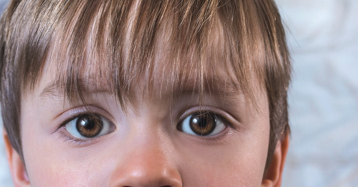 Pink Eye In Toddlers Identification Treatment How It S Spread