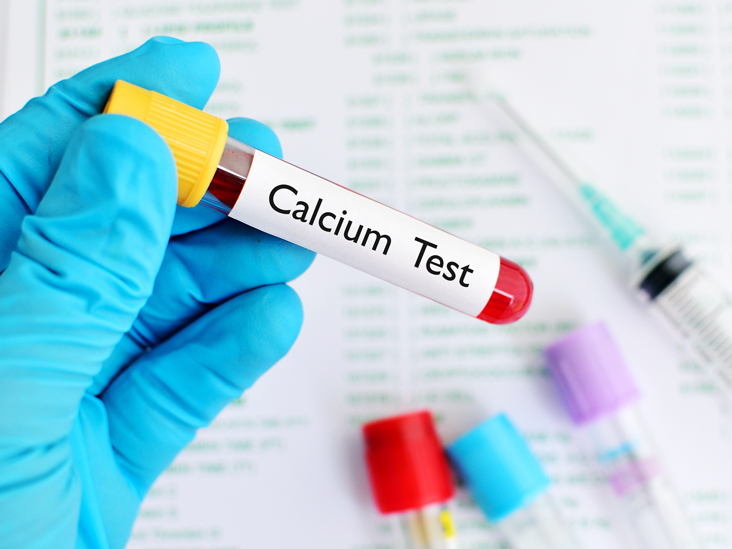 Calcium Blood Test Normal Range High Low