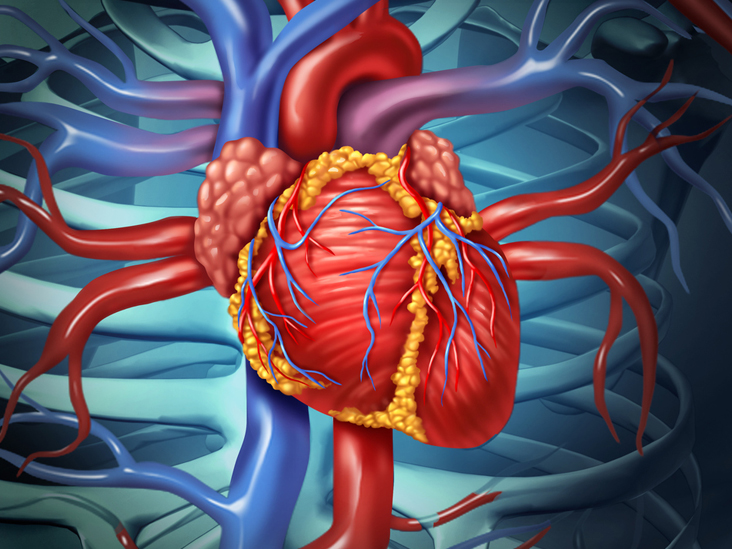 Chirurgie à cœur ouvert: Les risques, la procédure et la ...