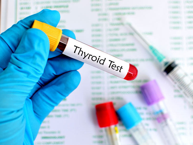 Thyroid Normal Levels Chart