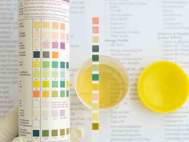Ph Levels In Urine Chart