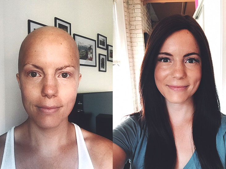 My Post-Chemo Makeup Routine That Makes Me Feel Like Myself