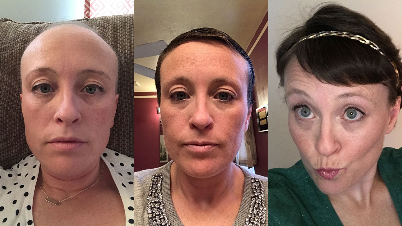 my chemotherapy diary: 52 photos of hair loss and recovery