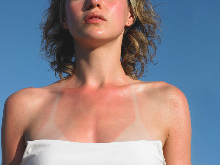 People Always Miss These 7 Body Parts with Sunscreen