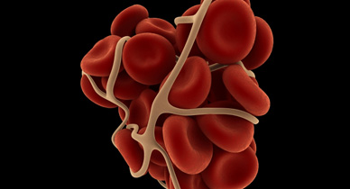 Image result for blood clots