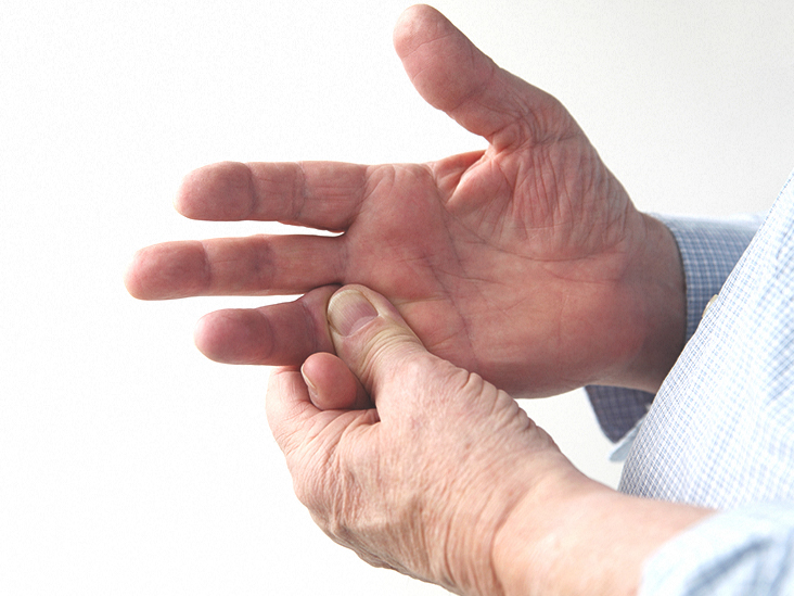 Sprained Finger Symptoms Home Treatments And More