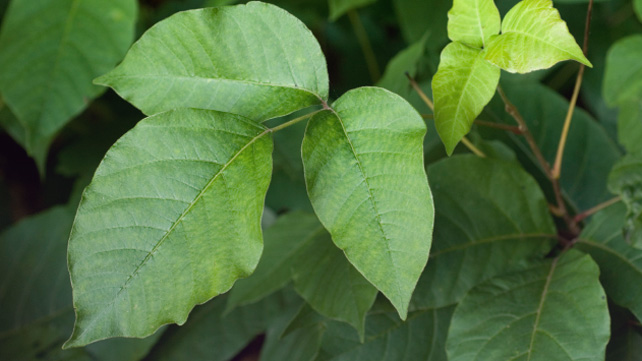 Poison Ivy Rash: Causes, Symptoms, and Treatments