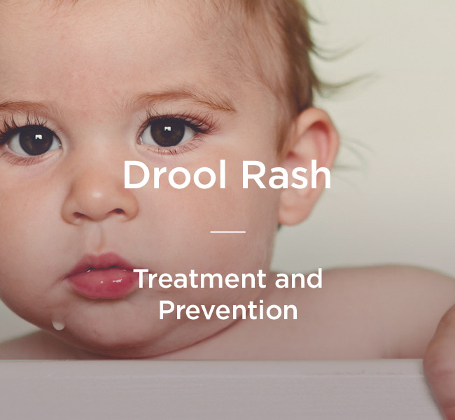 Drool Rash: How to Prevent and Treat It
