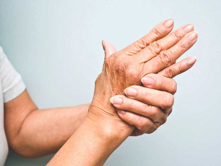 Psoriatic Arthritis: Types, Symptoms, Diagnosis, and More