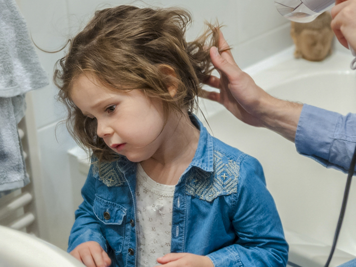 Hair Loss In Children Causes And Treatments
